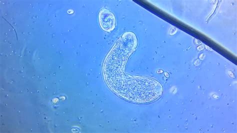  Leptomonas 무엇을 먹는 걸까요? 신비로운 편모충의 세상에 들어가 보세요!